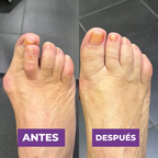 PROMO ANTI BUNION ORTOPEDICO