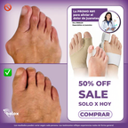 PROMO ANTI BUNION ORTOPEDICO